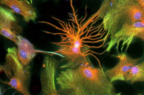 Neurone en orange entouré d'astrocytes en vert orangé, les noyaux sont bleus