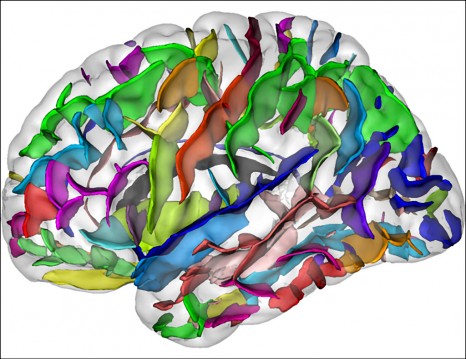 Etude des structures cérébrales de sujets sains ou pathologiques