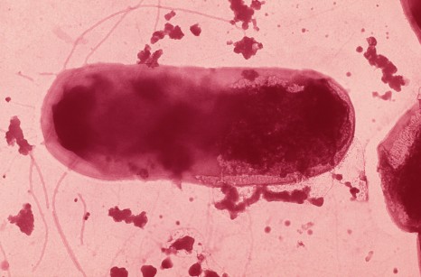 bacterie e.coli