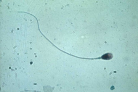 Spermatozoide-khochbin