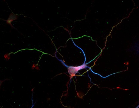 Transports vésiculaire spécifiques dans les neurones
