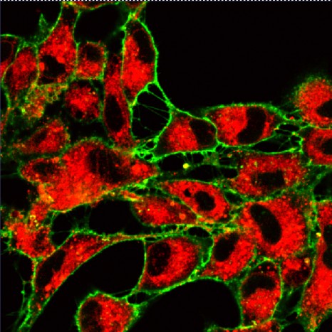 Membrane plasmique en vert, transferrine en rouge