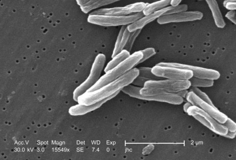 mycobacterium-tuberculosis