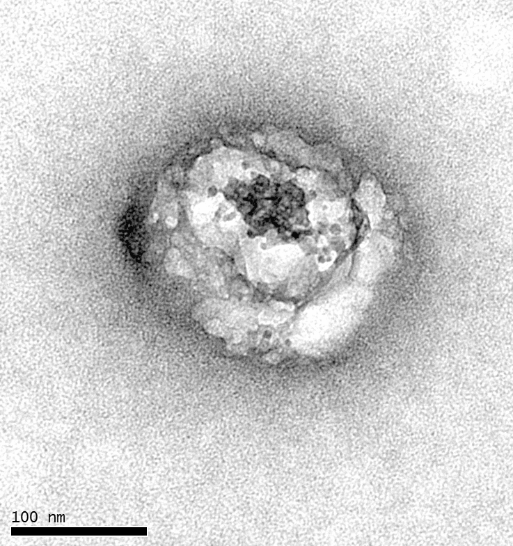 Le virus de l'hépatite C observé pour la première fois au ...