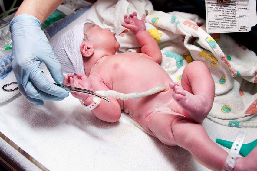 Sang cordon ombilical bébé