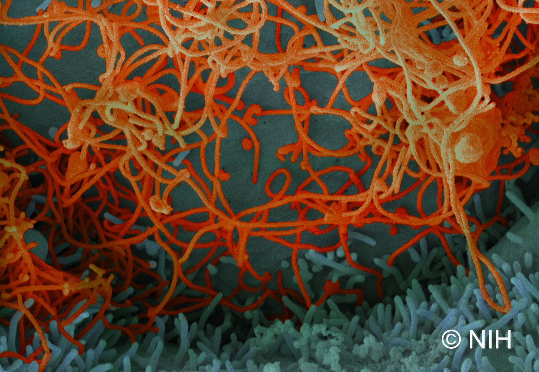 Virus Ebola dans un échantillon de sang