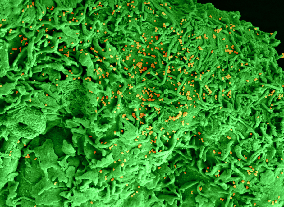 Microscopie électronique d’une cellule infectée par le SARS-CoV-2