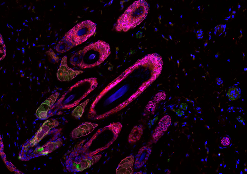 Co-marquages de peau de souris exprimant une mutation du gène PIK3CA