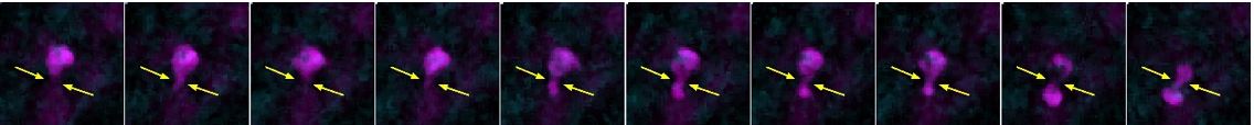 Observation en microscopie « 2-photons » de la déformation extrême d’un macrophage alvéolaire, lors de son passage entre deux alvéoles.