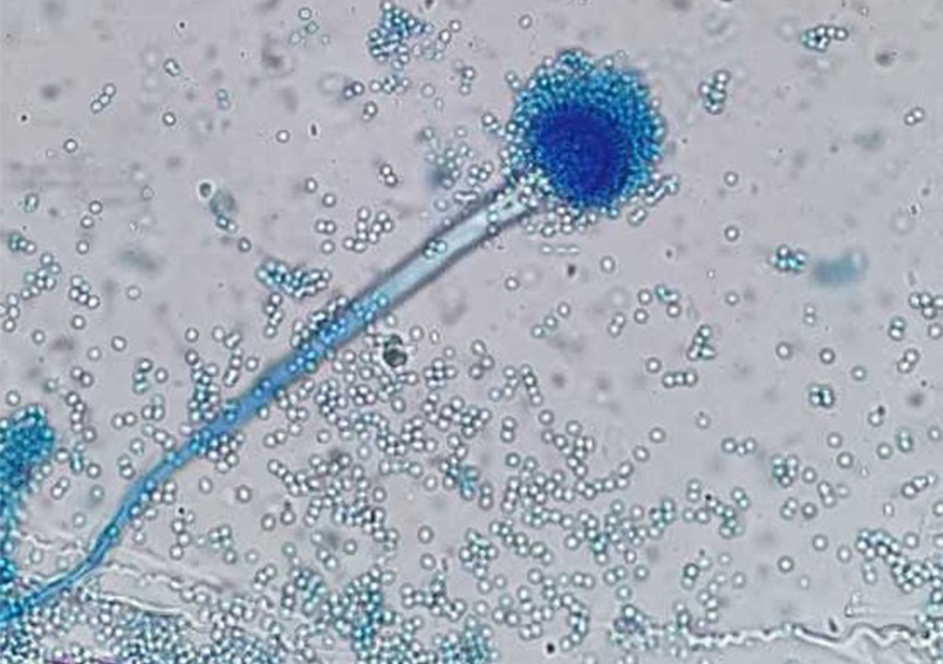Spores fongiques et "tête aspergillaire" du champignon microscopique Aspergillus fumigatus en culture (grossissement x 400)