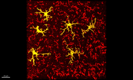 Microglies (en jaune, cellules immunitaires du cerveau)