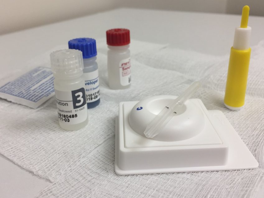 Kit de test utilisé pour détecter rapidement les anticorps anti-VIH dans le sang humain.