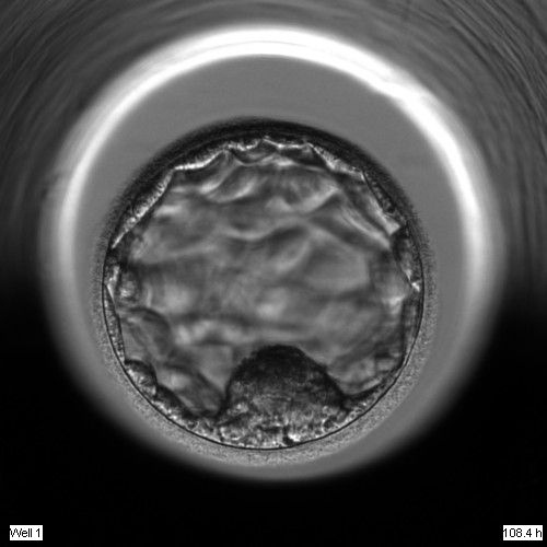 Embryon obtenu après une fécondation in vitro
