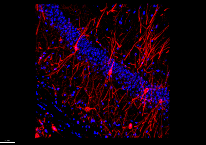 Augmentation neuronale du récepteur A2A dans l’hippocampe de souris