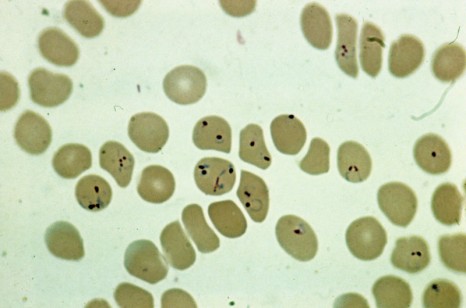 paludisme_inserm_7274 plasmodium globule rouge
