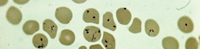 Paludisme : Le parasite P. vivax infecte des populations considérées comme résistantes