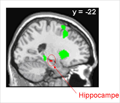 cp-hippocampe-15-fev-2011