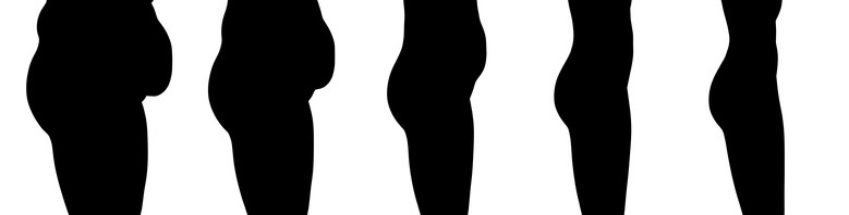 French national epidemiological survey on overweight and obesity