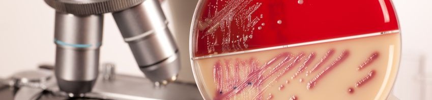 Mise au point de deux tests de diagnostic rapide de résistance aux antibiotiques