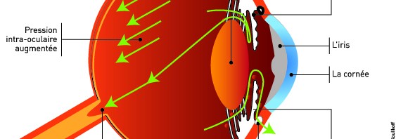 Oeil artificiel : des résultats prometteurs