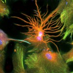Neurone en orange entouré d'astrocytes en vert orangé, les noyaux sont bleus