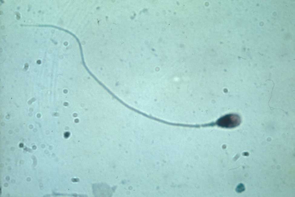 Спермий мха. Микроскопия сперматозоидов. Сперматозоиды млекопитающего в микроскопе. Строение сперматозоида микроскоп. Сперматозоид микрофотография.