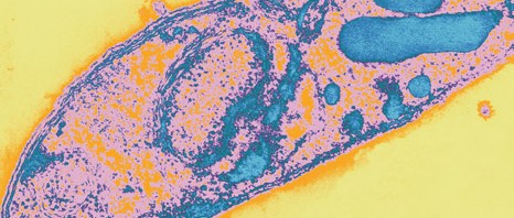 Fine-tuning the approach to malaria and toxoplasmosis research