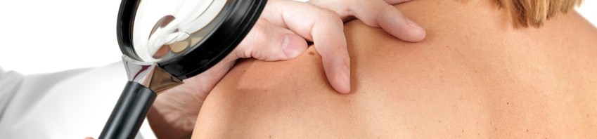 National Day of Screening for Skin Cancer
