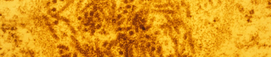 Bone marrow cancer remission thanks to measles virus