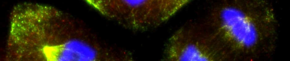 Des neurones d’emblée trop sensibles au stress cellulaire dans la maladie de Huntington