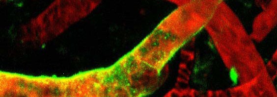 Les cellules dendritiques contrôlent la porte d’entrée des lymphocytes dans les ganglions lymphatiques