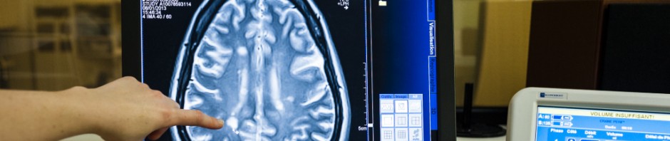 Measuring gray matter to predict recovery from coma