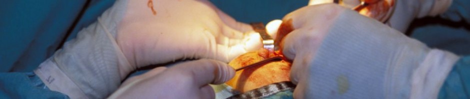 One third of caesareans could be avoided