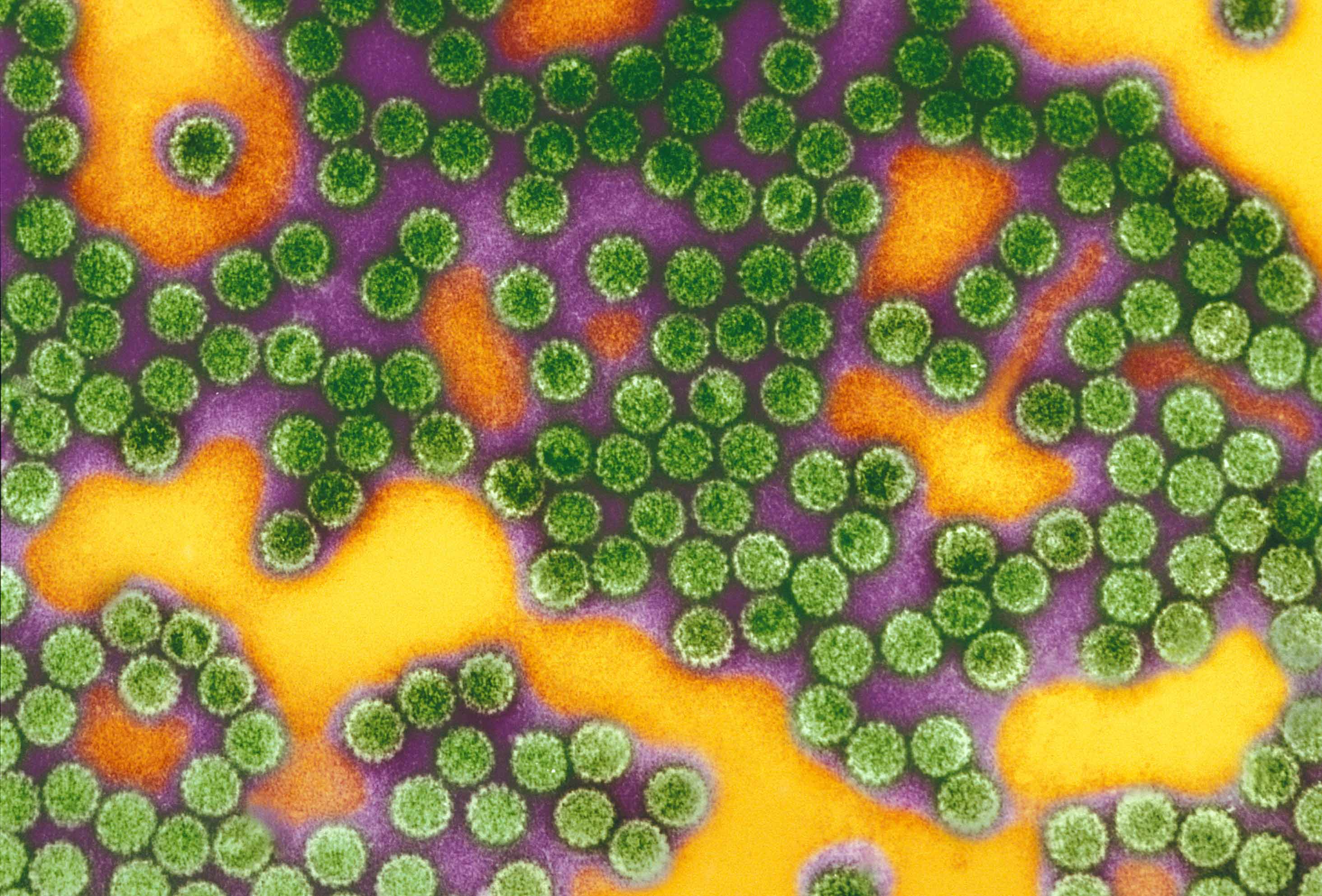 Human papillomavirus linked to auto-immune disease | Newsroom | Inserm