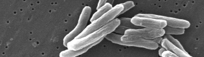 Tuberculose : une enzyme clé dans la résistance du germe aux antibiotiques
