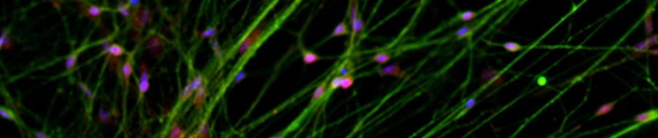 La fabrication de neurones moteurs humains à partir de cellules souches s’accélère