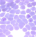 Plasmodium Falciparum globules rouges stade 2