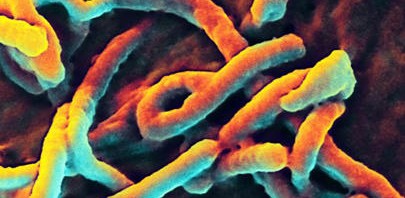 MSF and Inserm join their forces against Ebola : first trials