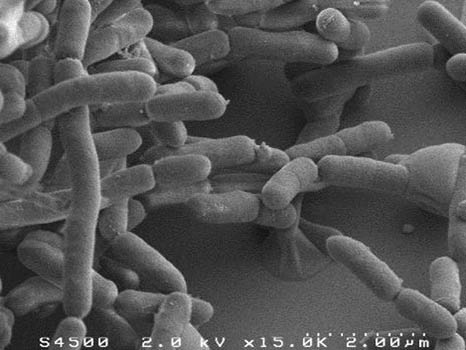 Inflammatory bowel disease: a gut bacterium with beneficial properties
