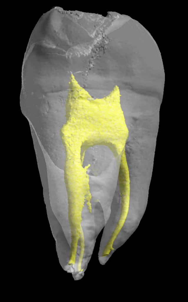 Natural reparative capacity of teeth elucidated
