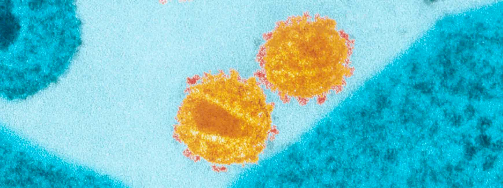 VIH : Identification de récepteurs clés de la réponse immunitaire chez les patients contrôlant spontanément l’infection