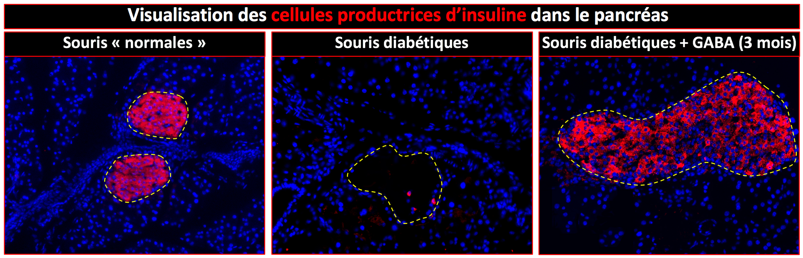 A molecule to regenerate insulin-producing cells in type 1 diabetic patients