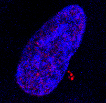 image d’amplification de centrosomes induite par l’infection par le virus Epstein Barr