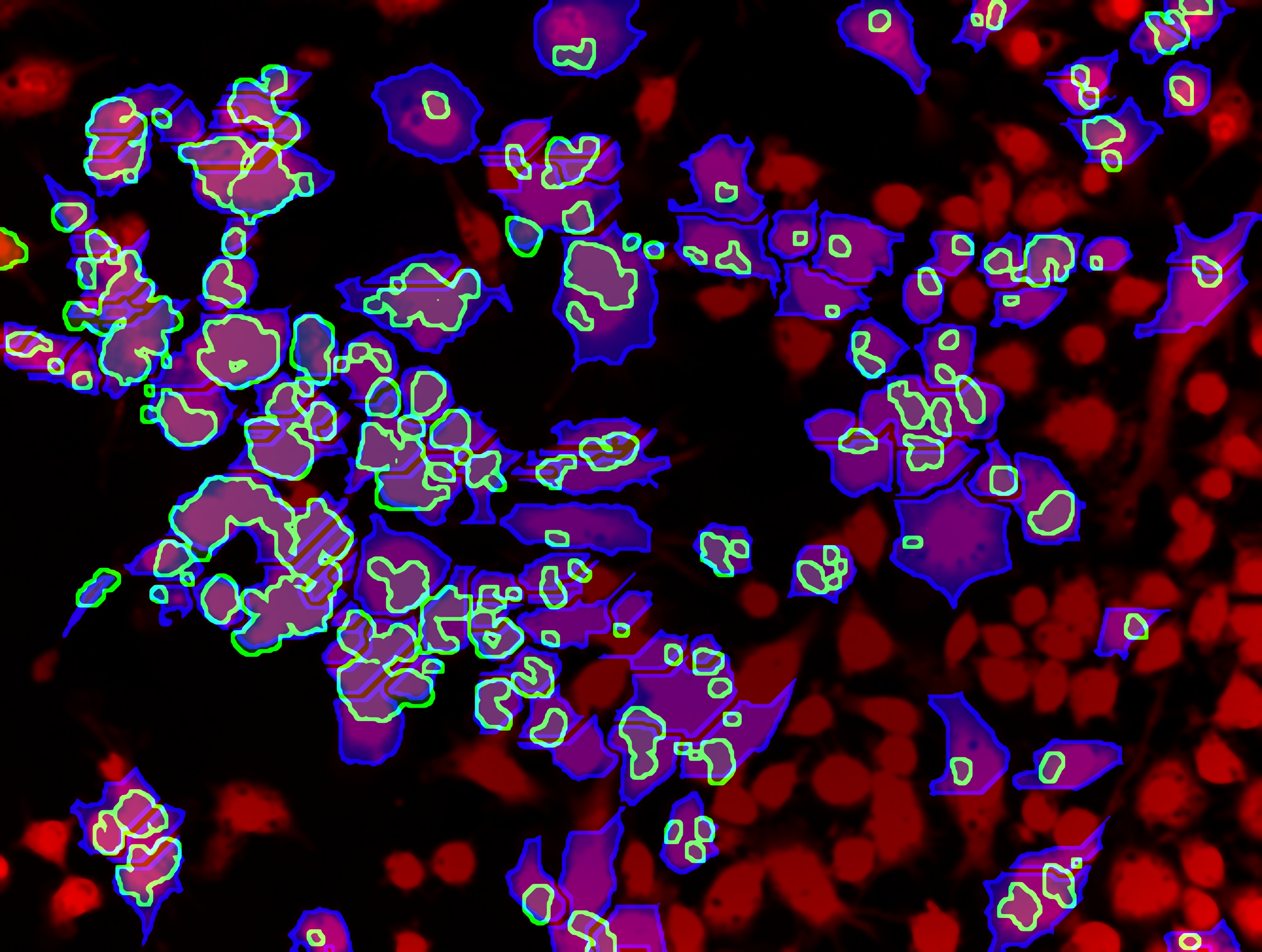 Une nouvelle maladie génétique liée au chromosome X explique les troubles de l’immunité face aux mycobactéries
