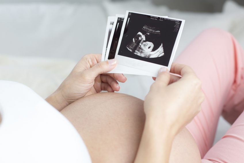Schwangere Frau liegend betrachtet Ultraschallbilder