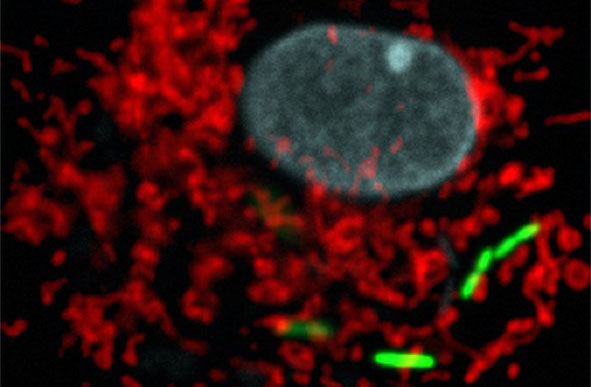 La bactérie responsable de la légionellose détourne le métabolisme des cellules infectées à son avantage