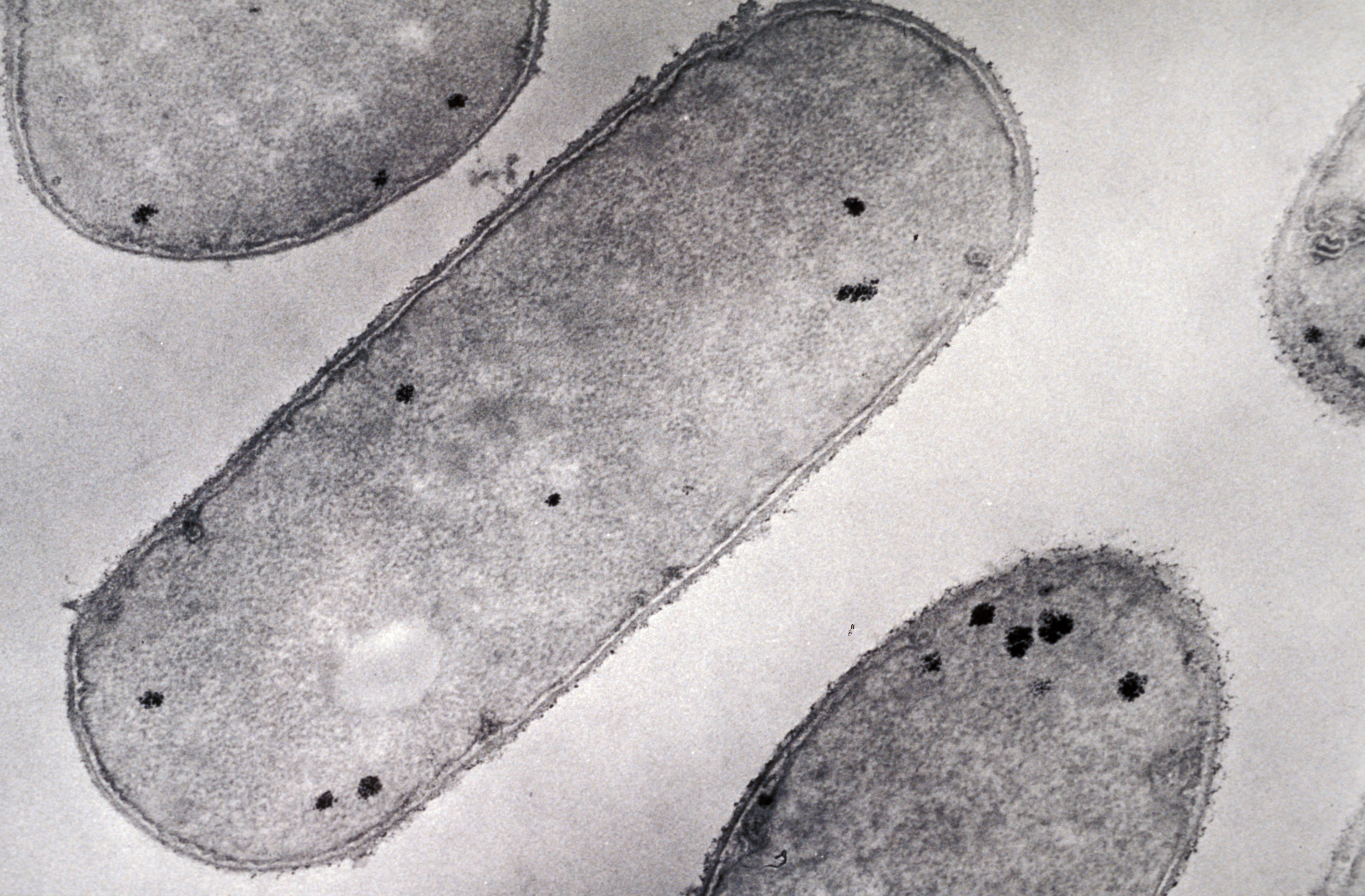 Bacillus cereus