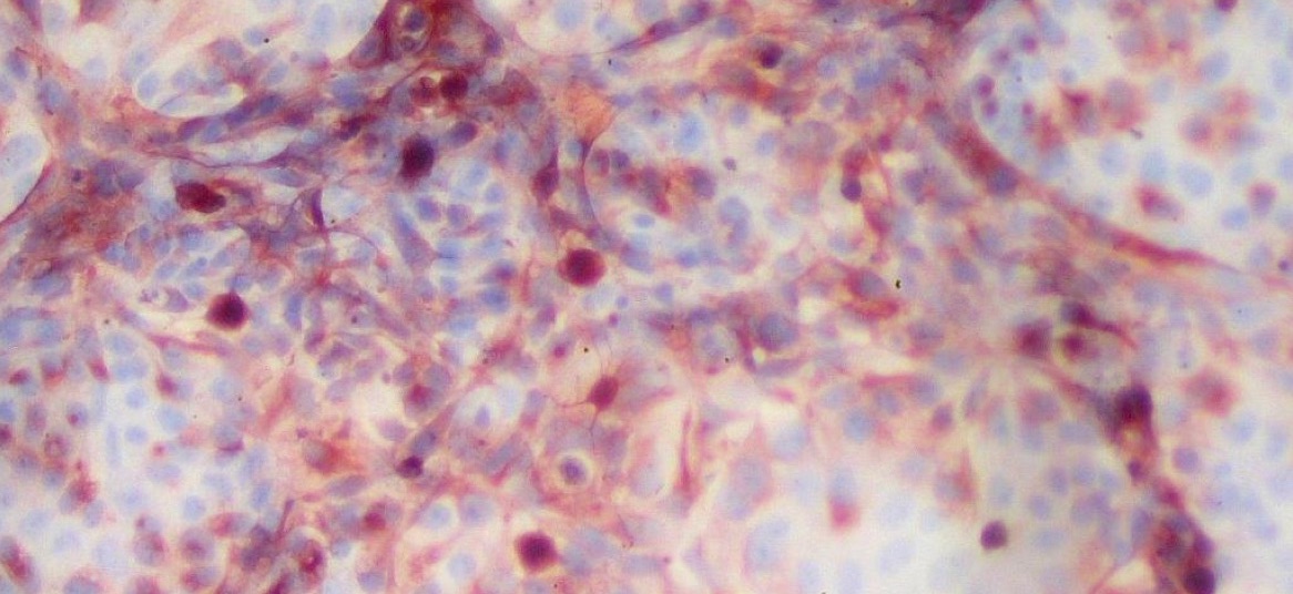 Yellow fever a new method for testing vaccine safety Newsroom Inserm