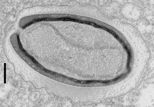 Pandoravirus: giant viruses invent their own genes