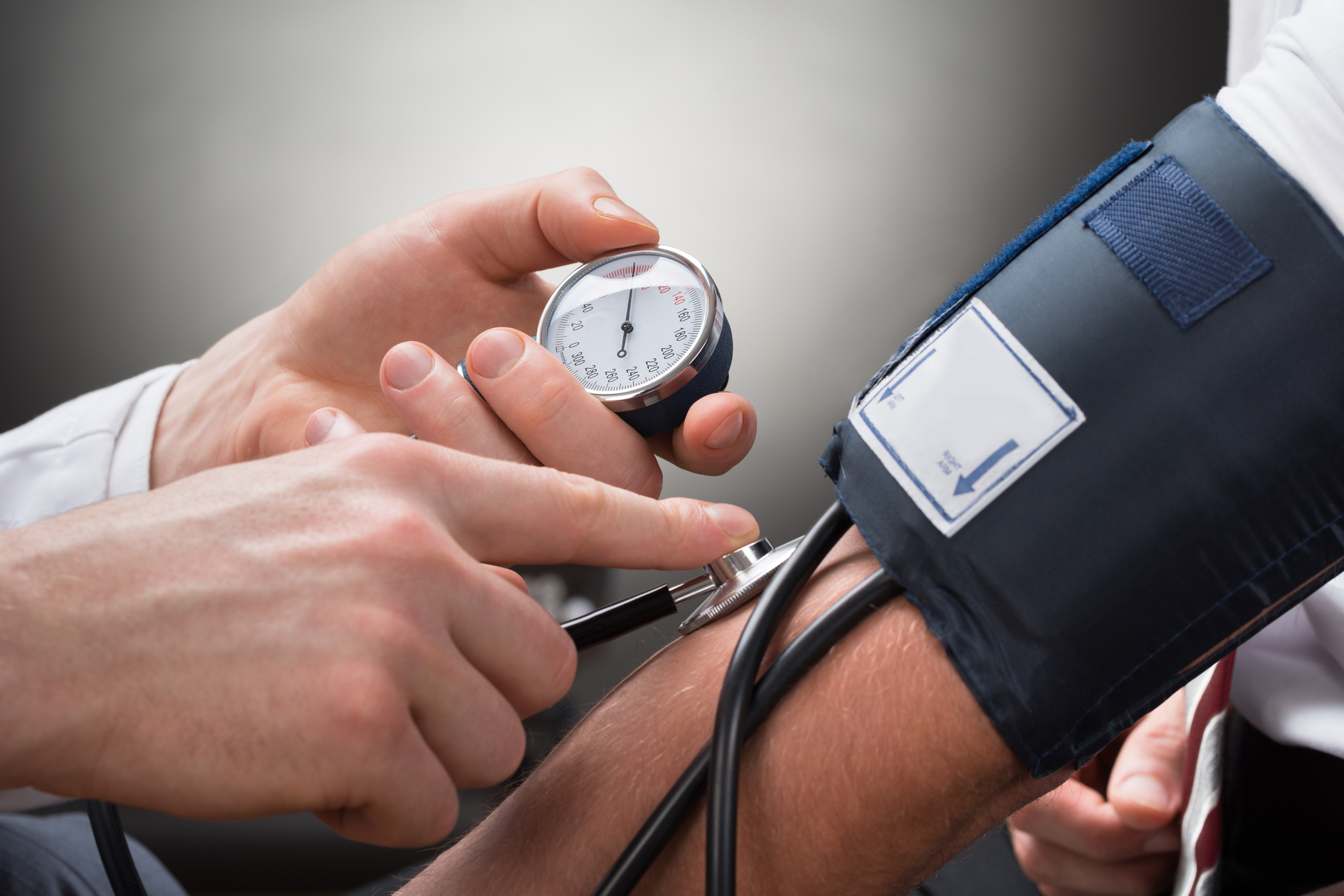 Hypertension: An international study shows the blood pressure benefit of endovascular renal denervation focused ultrasound in patients receiving no antihypertensive drug